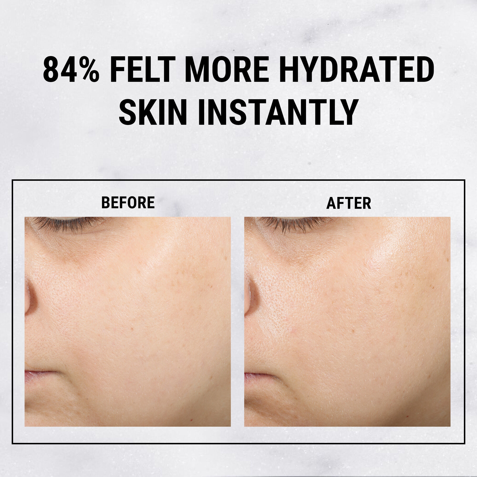 Ultra Pure High-Potency 1.5% Hyaluronic Acid Serum