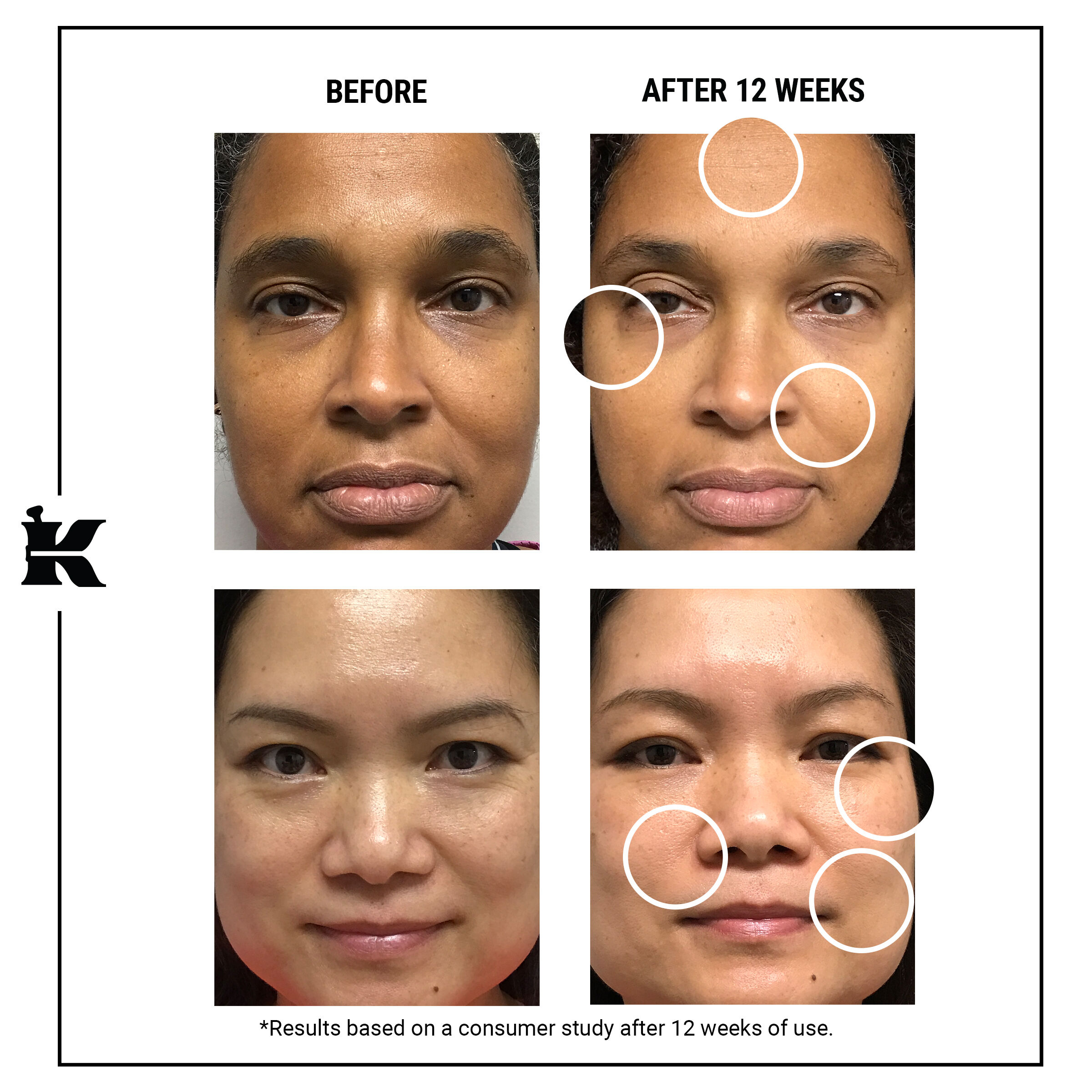 Retinol sales for skin