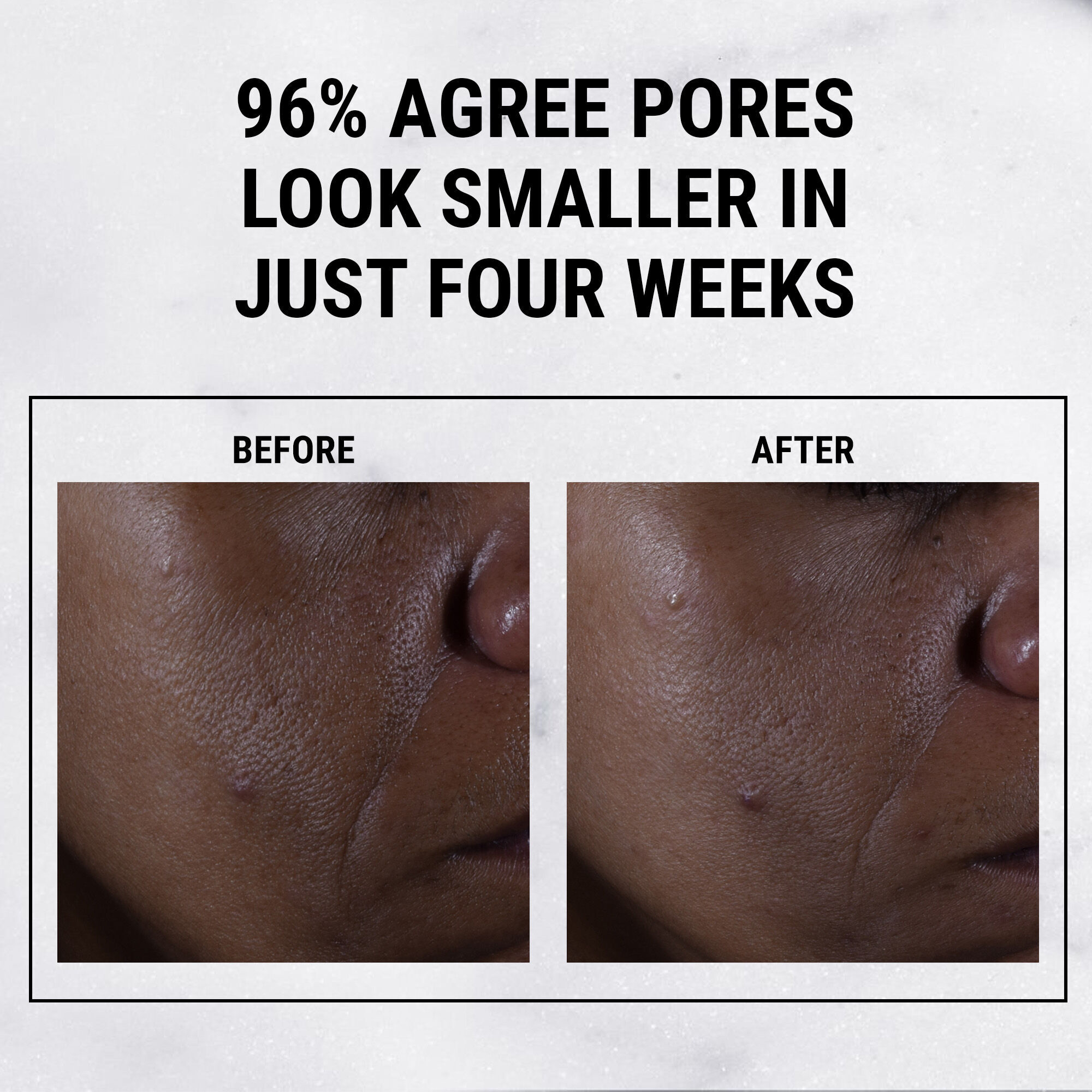 Ultra Pure High-Potency 9.8% Glycolic Acid Serum