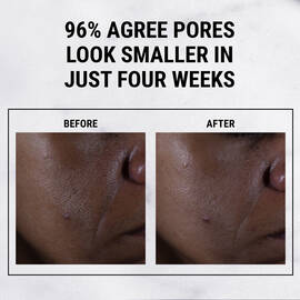 Ultra Pure High-Potency 9.8% Glycolic Acid Serum