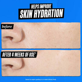 Ultra Pure High-Potency 1.5% Hyaluronic Acid Serum
