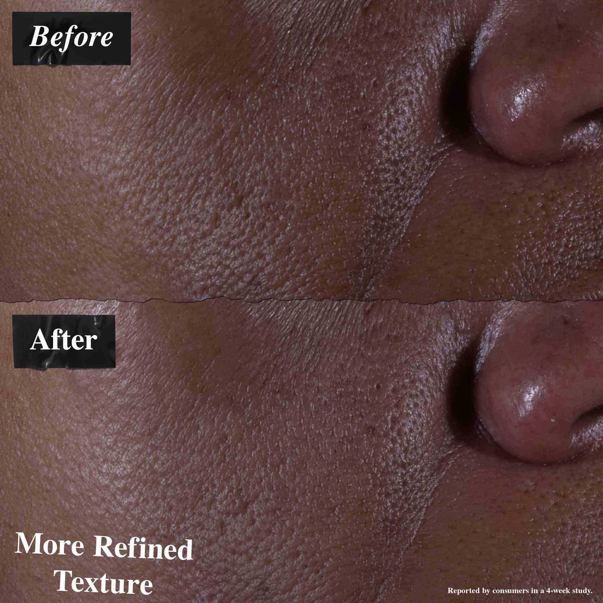 Ultra Pure High-Potency 9.8% Glycolic Acid Serum