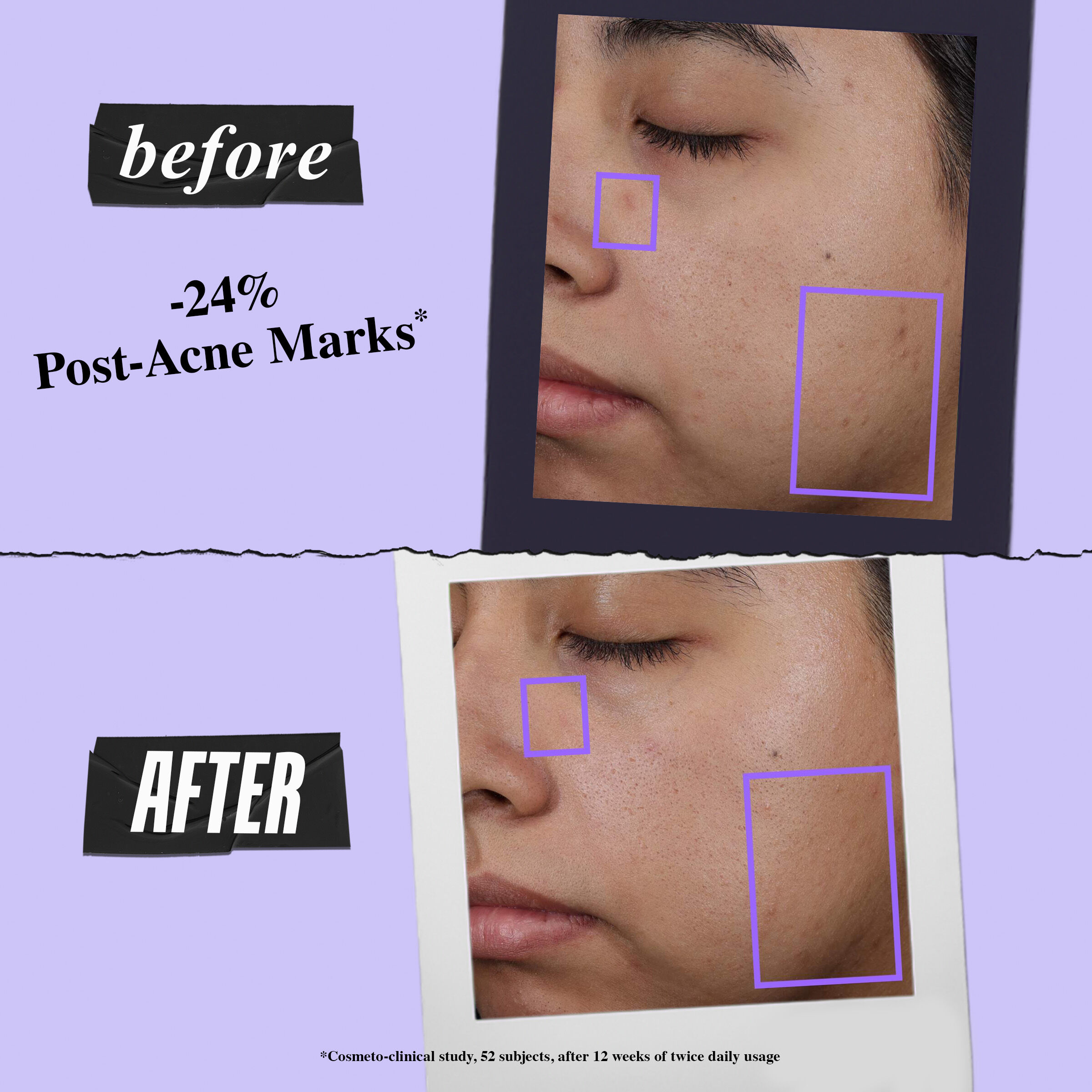 Clearly Corrective™ Clarity-Activating Soothing Emulsion