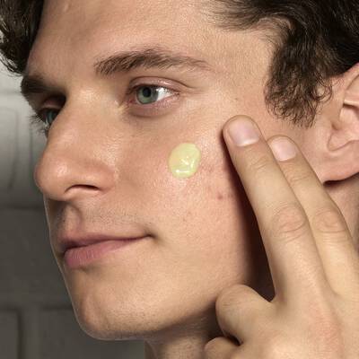 Dark Spots On Skin: Causes & Prevention